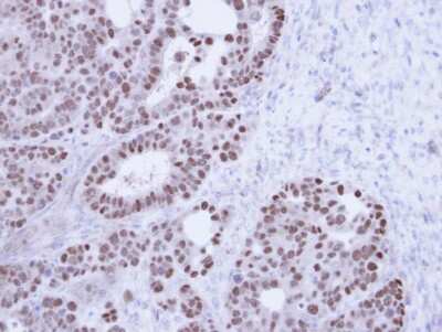 Immunohistochemistry-Paraffin: NXF1 Antibody [NBP1-31649]