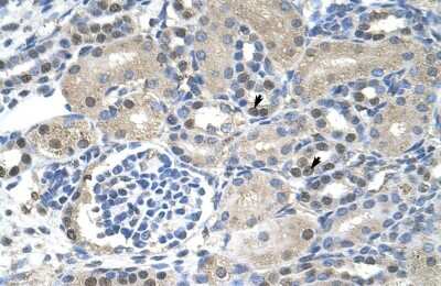 Immunohistochemistry-Paraffin: NXF1 Antibody [NBP1-57160]