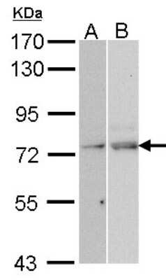 Western Blot: NXF1 Antibody [NBP1-31649]