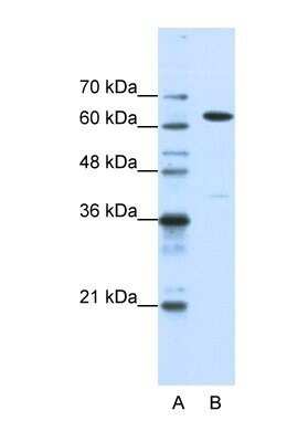 Western Blot: NXF1 Antibody [NBP1-57160]