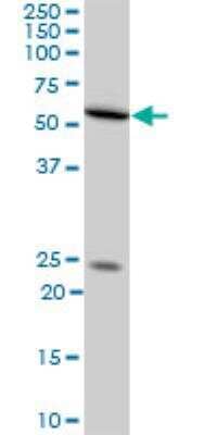 Western Blot: NXF2 Antibody (4G1) [H00056001-M08]