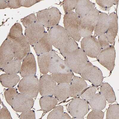 Immunohistochemistry-Paraffin: NXF2 Antibody [NBP1-85809]