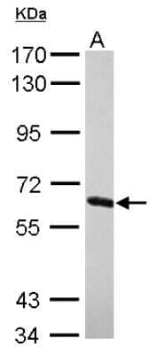 Western Blot: NXF2 Antibody [NBP2-15049]