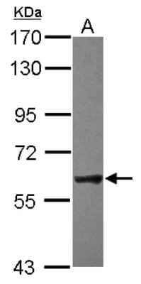 Western Blot: NXF2 Antibody [NBP2-15050]