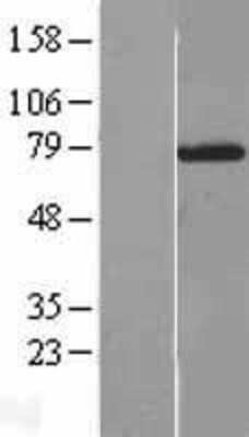 Western Blot: NXF2 Overexpression Lysate [NBL1-13889]