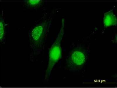 Immunocytochemistry/ Immunofluorescence: NXF3 Antibody (3A9) [H00056000-M06]