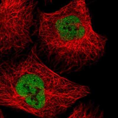 Immunocytochemistry/ Immunofluorescence: NXF3 Antibody [NBP2-38557]