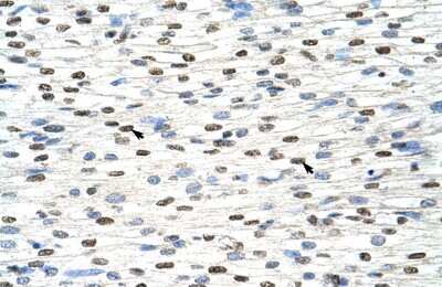 Immunohistochemistry: NXF3 Antibody [NBP1-57276]