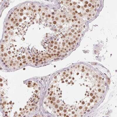 Immunohistochemistry: NXF3 Antibody [NBP2-38557]