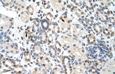 Immunohistochemistry-Paraffin: NXF3 Antibody [NBP1-57276]