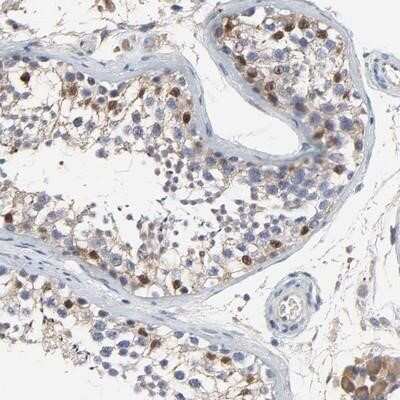 Immunohistochemistry-Paraffin: NXF3 Antibody [NBP1-89471]