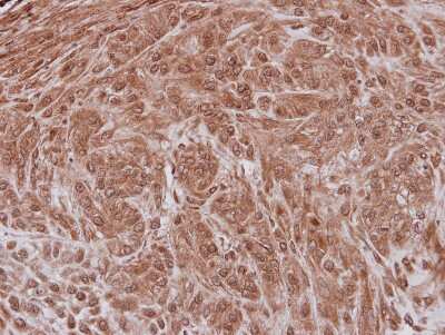 Immunohistochemistry-Paraffin: NXF3 Antibody [NBP2-19614]