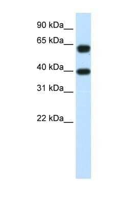 Western Blot: NXF3 Antibody [NBP1-57276]