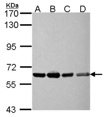 Western Blot: NXF3 Antibody [NBP2-19614]