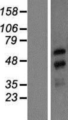 Western Blot: NXF3 Overexpression Lysate [NBP2-06459]