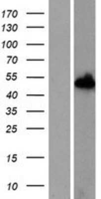 Western Blot: Nucleoredoxin Overexpression Lysate [NBP2-06438]