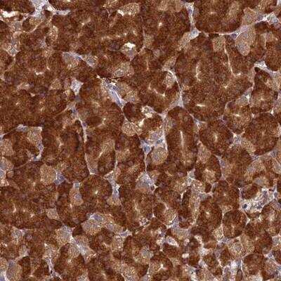 Immunohistochemistry-Paraffin: NXNL2 Antibody [NBP1-92215]