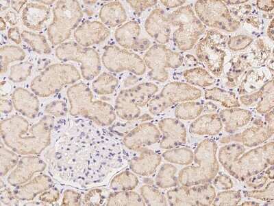 Immunohistochemistry-Paraffin: NXNL2 Antibody [NBP3-06016]