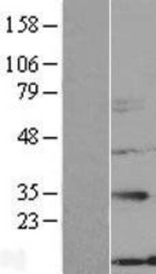 Western Blot: NXNL2 Overexpression Lysate [NBL1-13892]