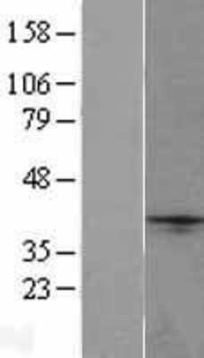 Western Blot: Neurexophilin-1 Overexpression Lysate [NBP2-05313]