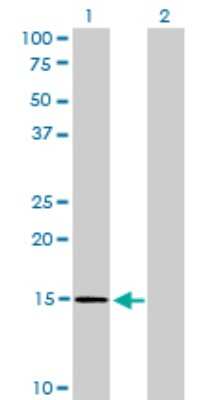 Western Blot: NXT1 Antibody (4F11) [H00029107-M08]