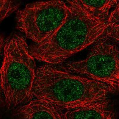 Immunocytochemistry/ Immunofluorescence: NXT1 Antibody [NBP2-57120]