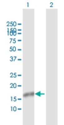 Western Blot: NXT1 Antibody [H00029107-D01P]