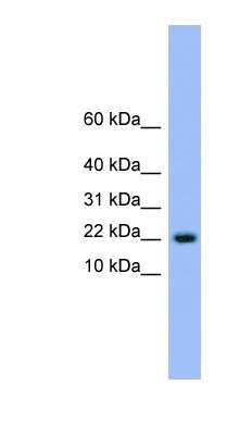 Western Blot: NXT1 Antibody [NBP1-79561]