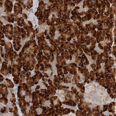 Immunohistochemistry-Paraffin: NXT2 Antibody [NBP1-80964]