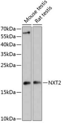 Western Blot: NXT2 AntibodyAzide and BSA Free [NBP2-93010]