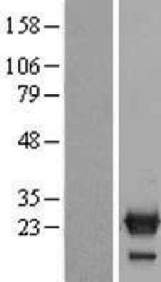 Western Blot: NXT2 Overexpression Lysate [NBP2-06763]