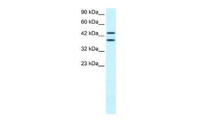 Western Blot: NY-REN-50 antigen Antibody [NBP2-83299]