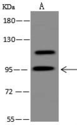 Western Blot: NY-REN-50 antigen Antibody [NBP3-12662]