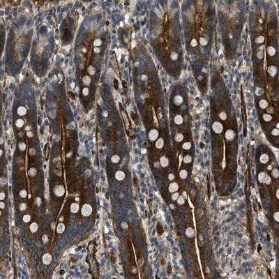 Immunohistochemistry-Paraffin: NYNRIN Antibody [NBP1-90632]