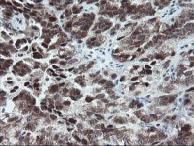 Immunohistochemistry-Paraffin: NUB1/NYREN18 Antibody (OTI4H2) [NBP2-03897]