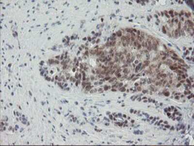 Immunohistochemistry-Paraffin: NUB1/NYREN18 Antibody (OTI4H2) [NBP2-03897]