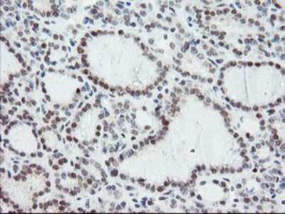 Immunohistochemistry-Paraffin: NUB1/NYREN18 Antibody (OTI4H2) [NBP2-03897]