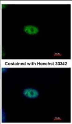 Immunocytochemistry/ Immunofluorescence: NUB1/NYREN18 Antibody [NBP2-19616]