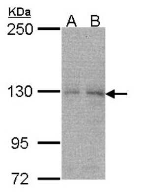 Western Blot: NUB1/NYREN18 Antibody [NBP2-19616]