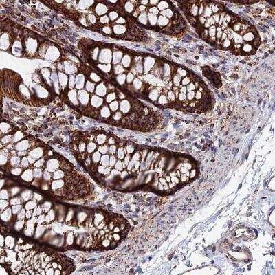 Immunohistochemistry: HAUS8 Antibody [NBP1-92217]