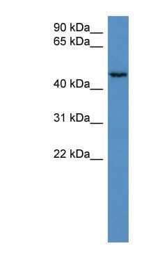 Western Blot: HAUS8 Antibody [NBP1-79780]