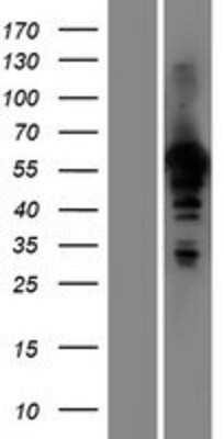 Western Blot: HAUS8 Overexpression Lysate [NBP2-05878]