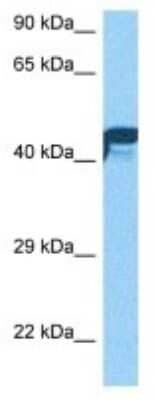 Western Blot: NYX Antibody [NBP3-10026]