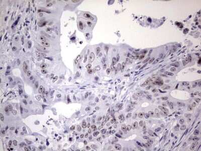 Immunohistochemistry: Nab2 Antibody (OTI5D7) [NBP2-46080]