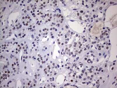 Immunohistochemistry: Nab2 Antibody (OTI5D7) [NBP2-46080]