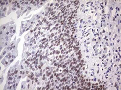 Immunohistochemistry: Nab2 Antibody (OTI5D7) [NBP2-46080]