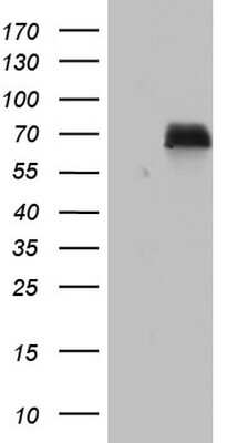 Western Blot: Nab2 Antibody (OTI5D7) [NBP2-46080]