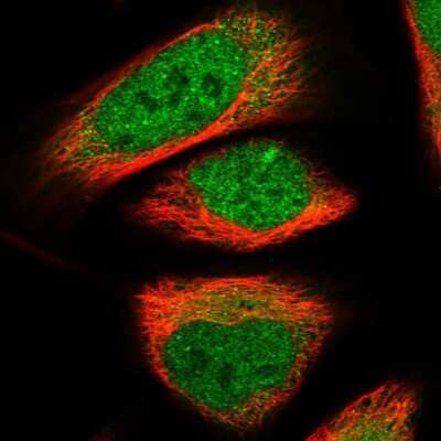 Immunocytochemistry/ Immunofluorescence: Nab2 Antibody [NBP1-82804]