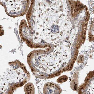 Immunohistochemistry-Paraffin: Nab2 Antibody [NBP1-82804]