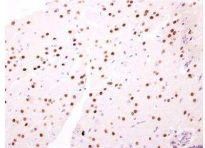 Immunohistochemistry-Paraffin: Nab2 Antibody [NBP2-19462]